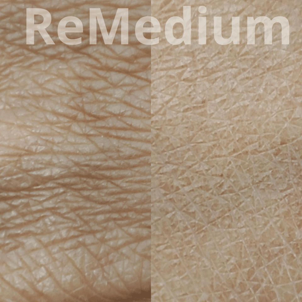 ReMedium Aqua (2x2ml) - obrazek 3