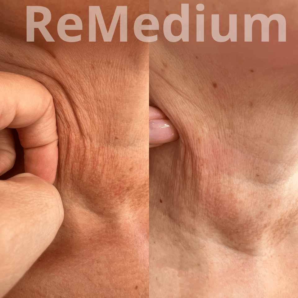ReMedium Aqua (2x2ml) - obrazek 4